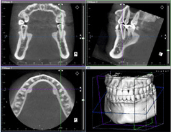 CT2.gif